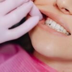 Evita normalizar el dolor de dientes: detecta a tiempo el bruxismo